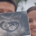 Smiling Couple Holding an Ultrasound Image of Their Developing Fetus Outdoors. - Tu Vecino Informa